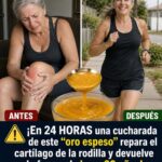 Dolor de rodilla después de los 50: ¿puede un remedio casero “reparar” el cartílago?