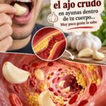 Ajo crudo en ayunas: ¿realmente “limpia” las arterias?