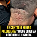Irritación en la nuca: por qué aparece y qué hacer para evitar que empeore
