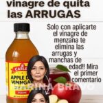Vinagre de manzana para las arrugas: ¿realmente rejuvenece la piel?